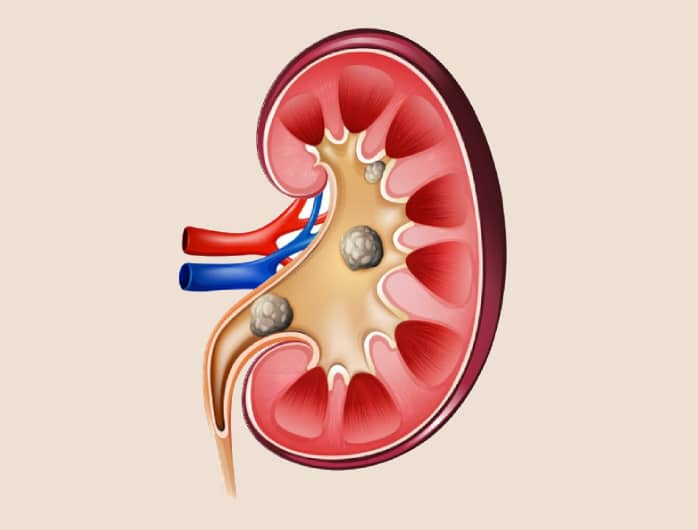 Nephrologist in Theni