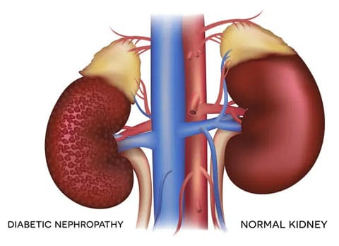 Nephrologist in Mudukulathur