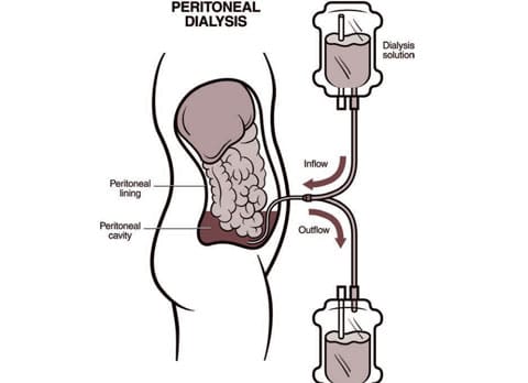 Nephrologist in Singampunari